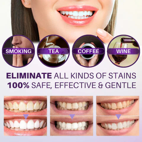 Hismile V34 Teeth Whitening Toothpaste