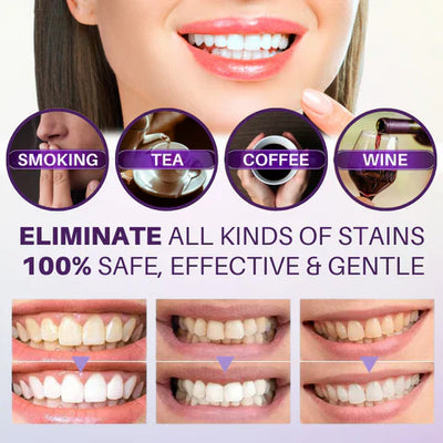 Hismile V34 Teeth Whitening Toothpaste